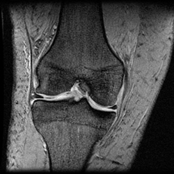 knee-surgery3